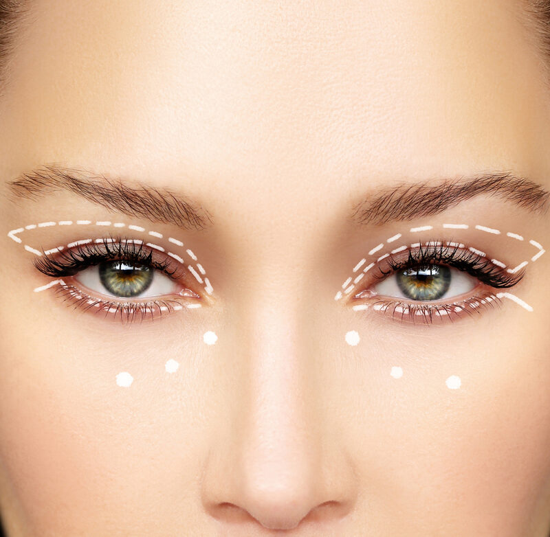 Blefaroplastia Inferior/Superior