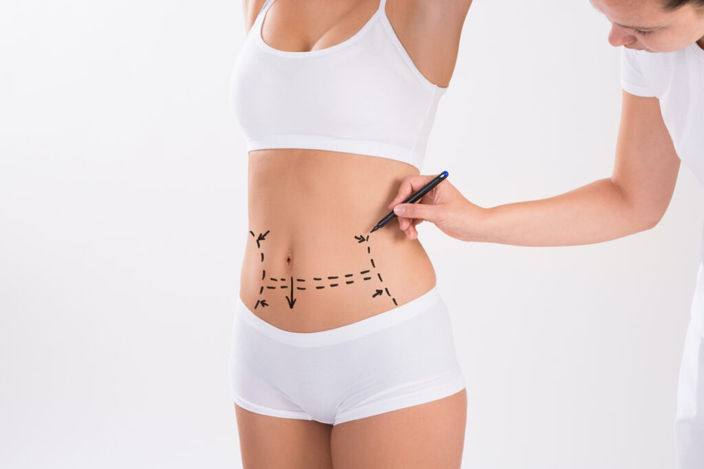 O que dói mais, lipo ou abdominoplastia - Clínica Infinity
