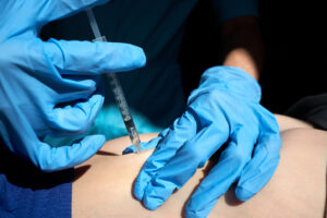 Qual é a lipoaspiração menos invasiva - Clínica Infinity