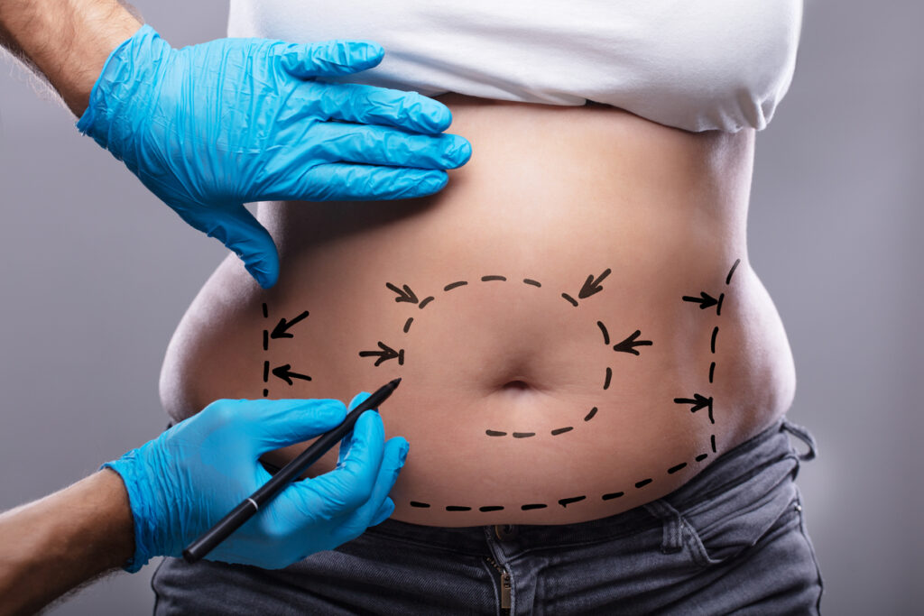 Qual o valor de uma lipoabdominoplastia?