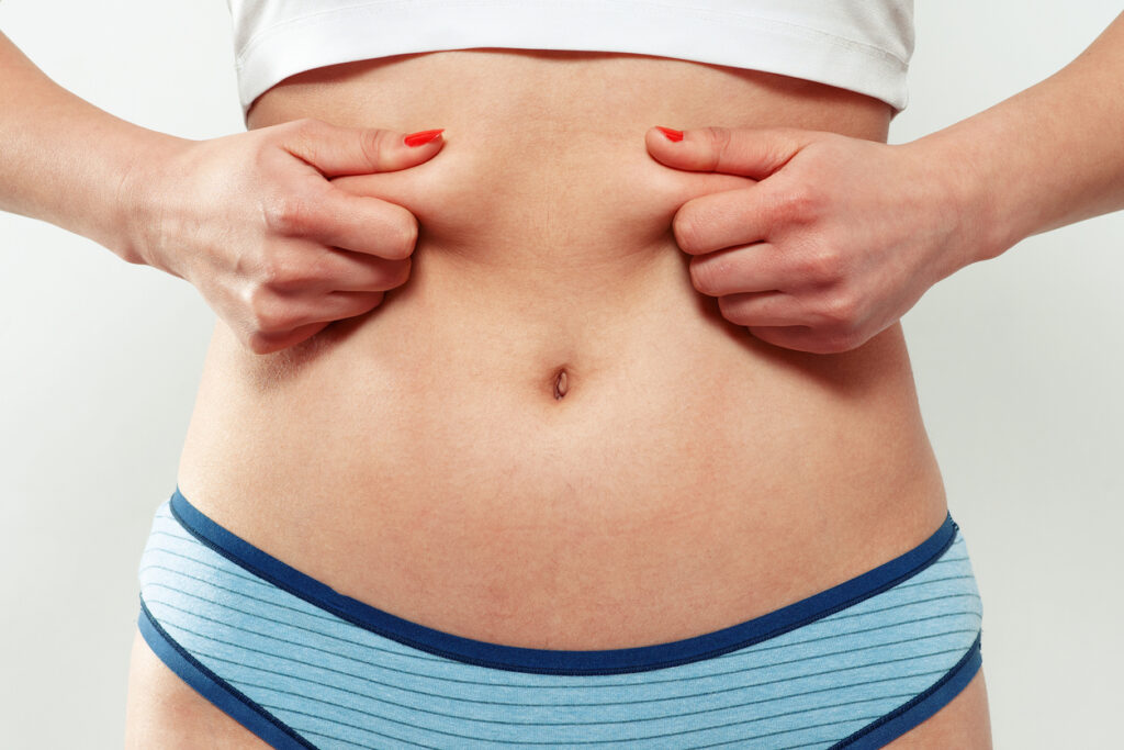 Como é uma abdominoplastia reversa?