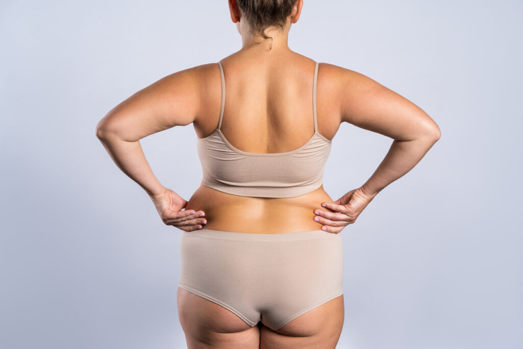 Torsoplastia Vertical