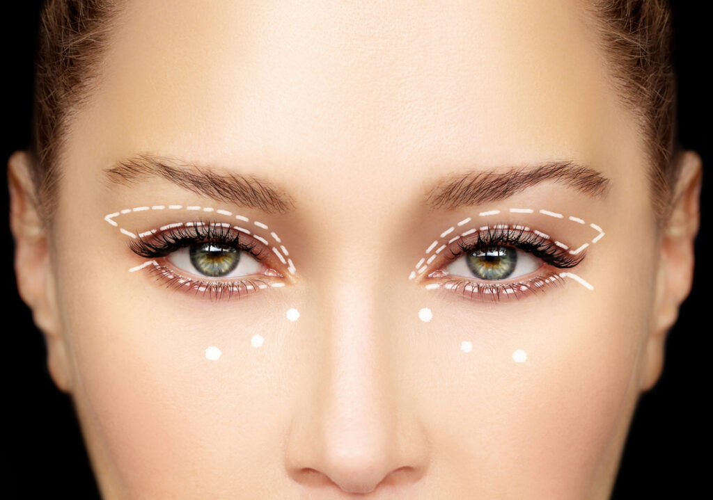 substitutos da blefaroplastia