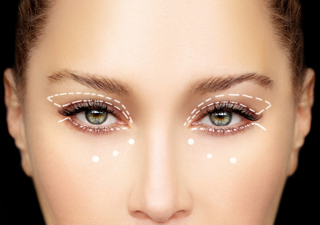 substitutos da blefaroplastia