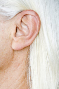 Qual a melhor idade para fazer a cirurgia de otoplastia?