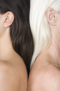 motivos para cirurgia de otoplastia